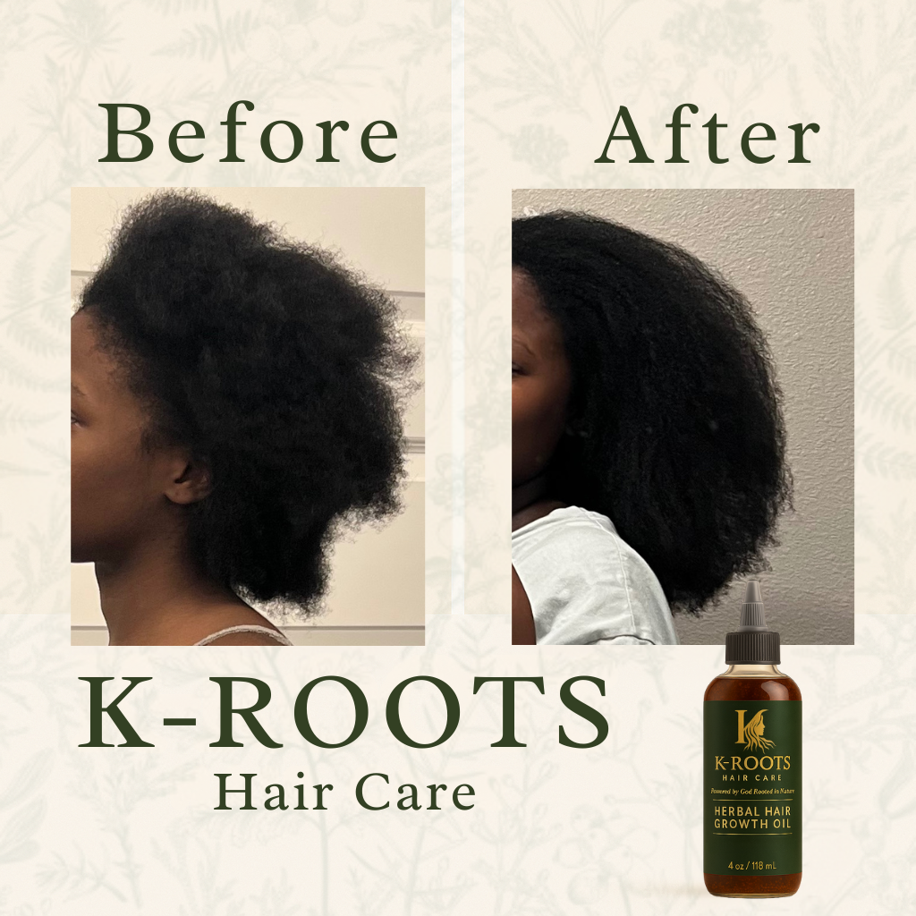 Herbal Hair Growth Oil
