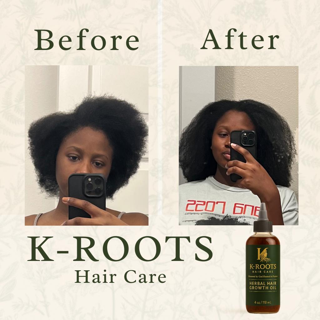 Herbal Hair Growth Oil